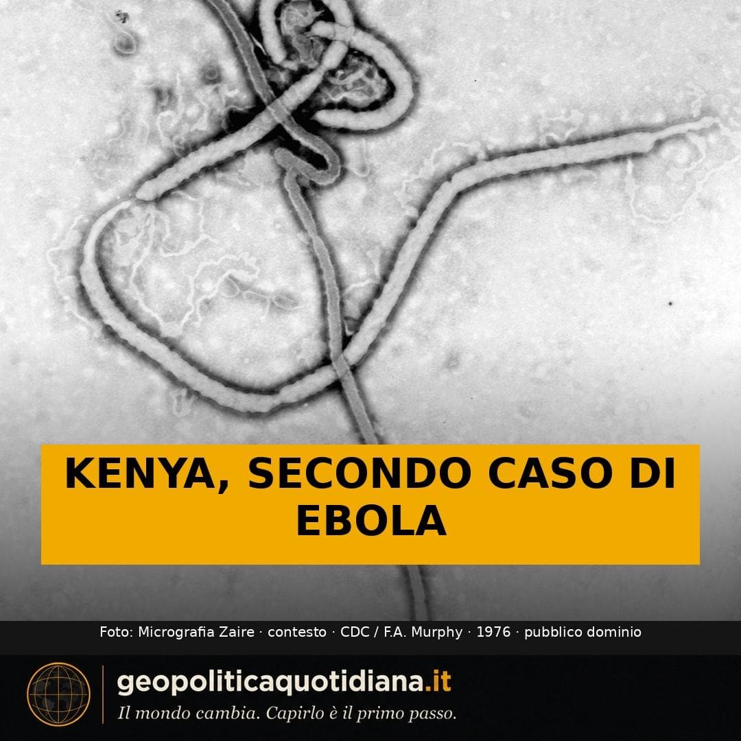 Anteprima del post Instagram